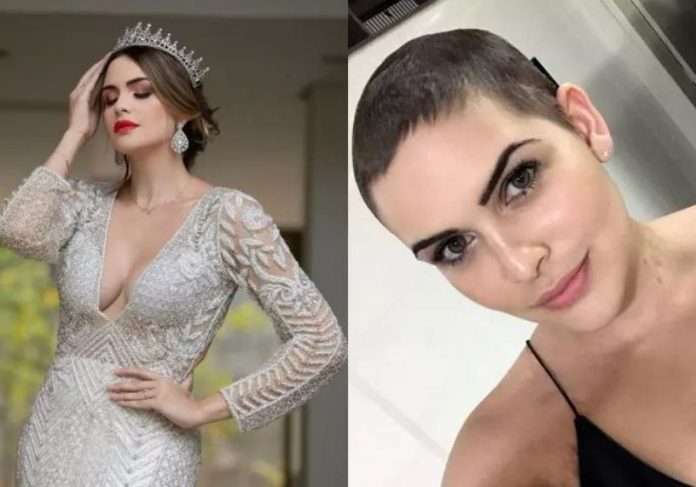 Mineira supera câncer raro e vence Miss Brasil Internacional